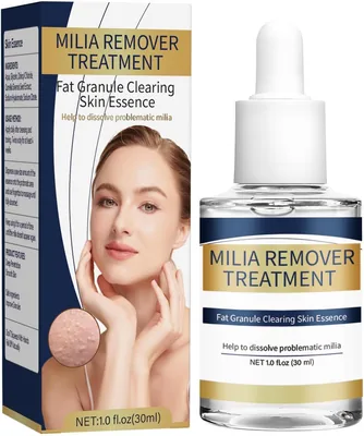 Milia Removal Face Serum - Best Deal