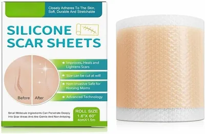 Medical-Grade Silicone Scar Sheet Roll - Reusable for Scars