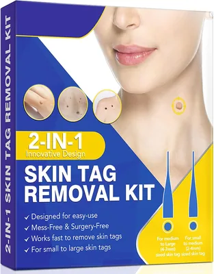 Auto Skintake Remover Tool Set, Skin Tag Removal Kit - Best Deal