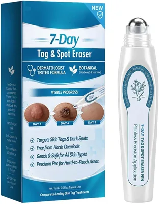 Tag and Spot Eraser Rollerball - Best Deal