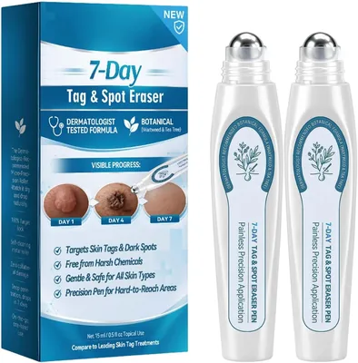 7-Tage-Fleckenentferner mit Präzisions-Rollerball, Natürliche Gel-Hautpflege für Flecken und Anhaftungen - Best Deal
