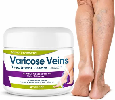 Crema per Varici e Capillari: Alleviare il Pesantezza delle Gambe | Formula Naturale con Arnica e Aloe Vera, 48% di Sconto