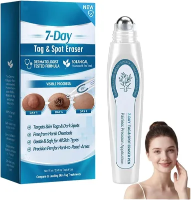 Rolon Anti Manchas Avanzado, 15ML SKIN-FINKLES | Removedor de Callosidades Picdo, Ingredientes Naturales para Granos de Edad y Molestias